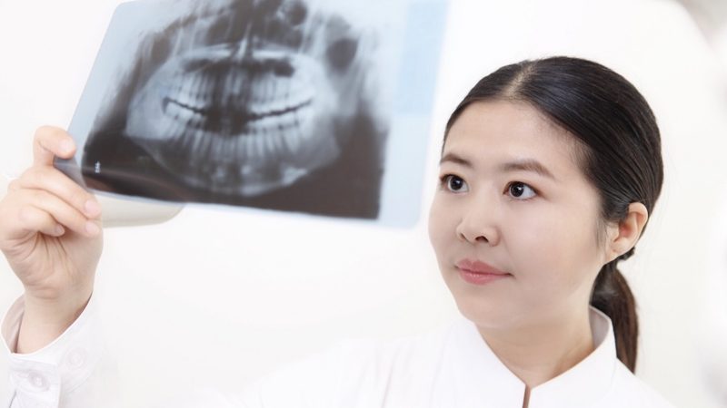 树脂补牙与玻璃离子：哪种材料更持久？**
